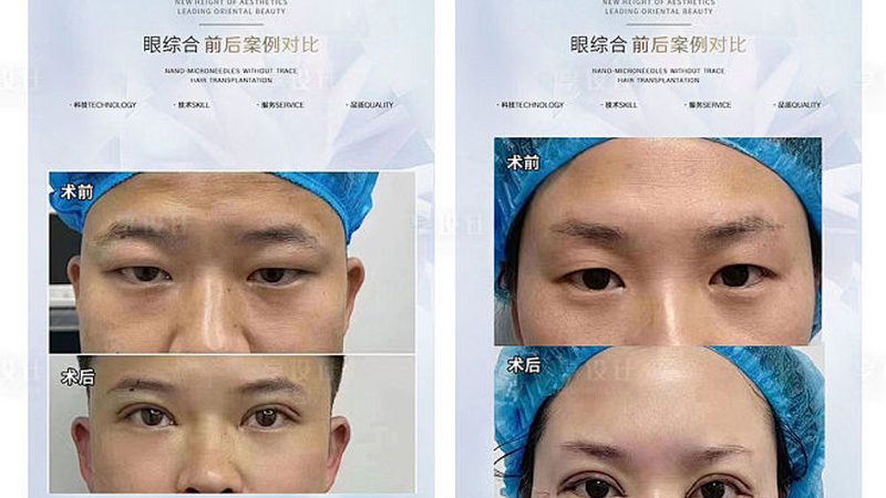 行业现状：安全与效果并重