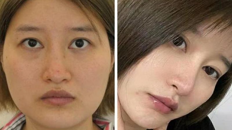 抗衰新宠：胶原蛋白肽与维生素C的完美搭配