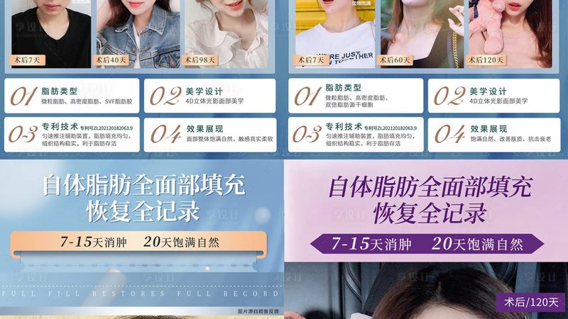 IPL激光祛斑仪：揭秘最新款技术与报价