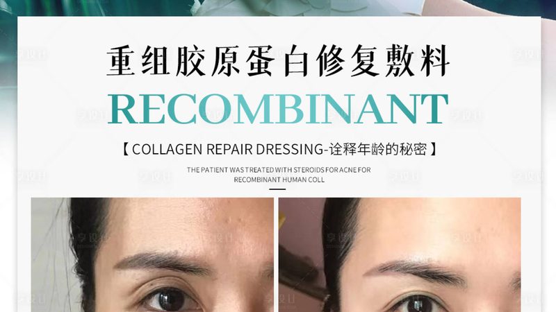 肉毒素厂家直供：揭秘价格背后的真相