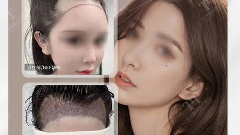 医美咨询师转行需要什么证书