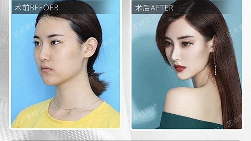 小标题：术后护理的重要性