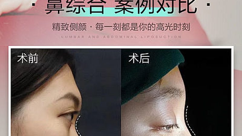50岁女性抗衰口服液，揭秘如何科学选择