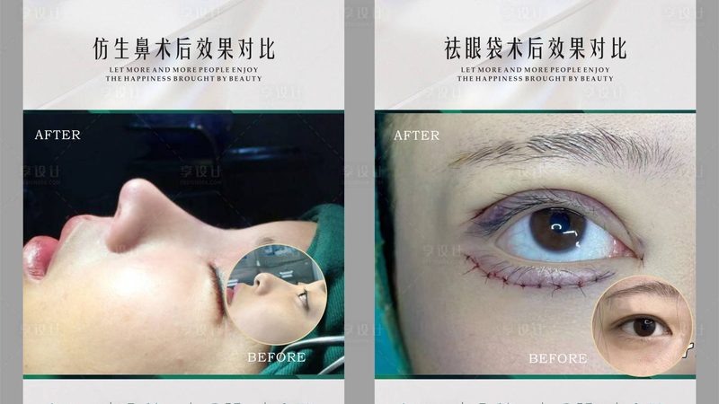 注射美容，价格背后的秘密与考量