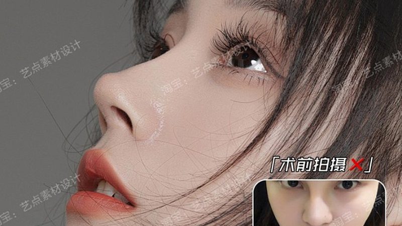 黄褐斑、雀斑、晒斑，激光到底能打掉哪种