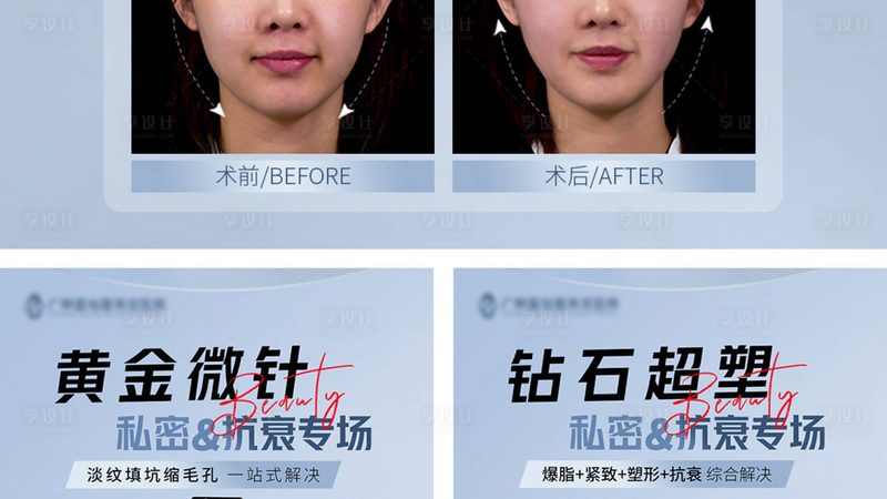 成都玻尿酸注射哪家医院好