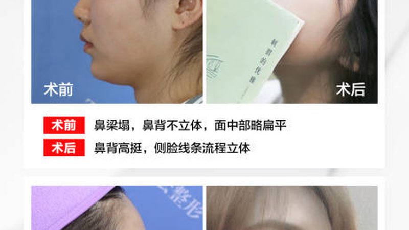 玻尿酸护肤品OEM，揭秘行业规范背后的秘密