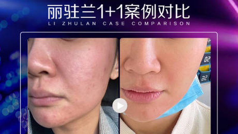 小标题：正确洗脸，预防感染
