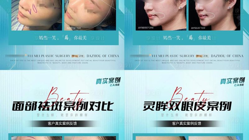 韩式隆鼻VS自然隆鼻，效果对比图揭示差异