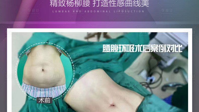揭秘皮肤管理仪器：厂家直销，OEM支持背后的技术奥秘