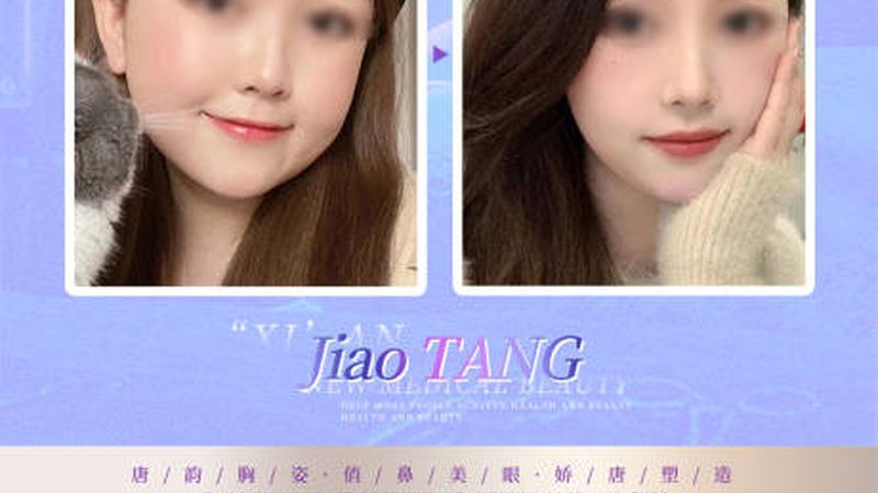 微整形与手术整形的较量：效果差异解析