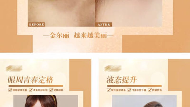 激光祛斑，定制方案背后的技术解析
