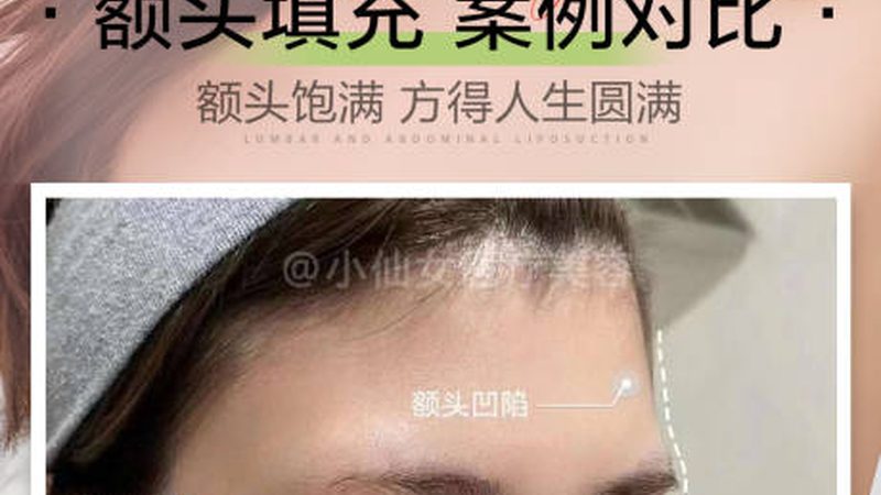抗衰激光与超声刀：副作用对比解析