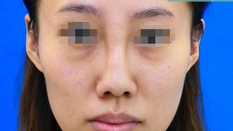 国产医美仪器哪个牌子好